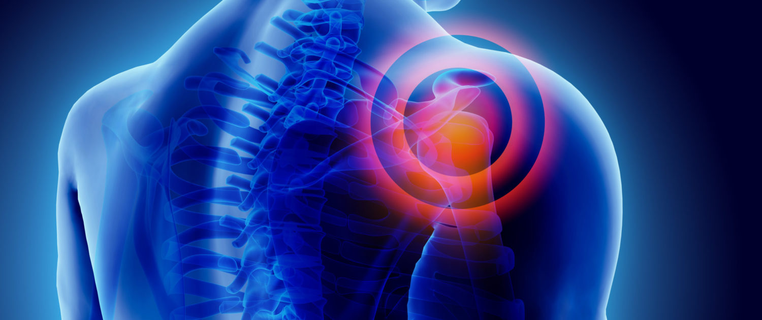 3D Illustration of shoulder painful.